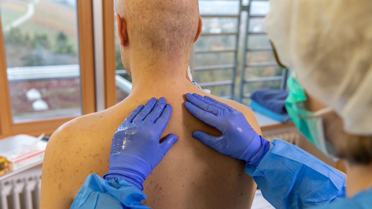 A patient receives an oil application on the ward.